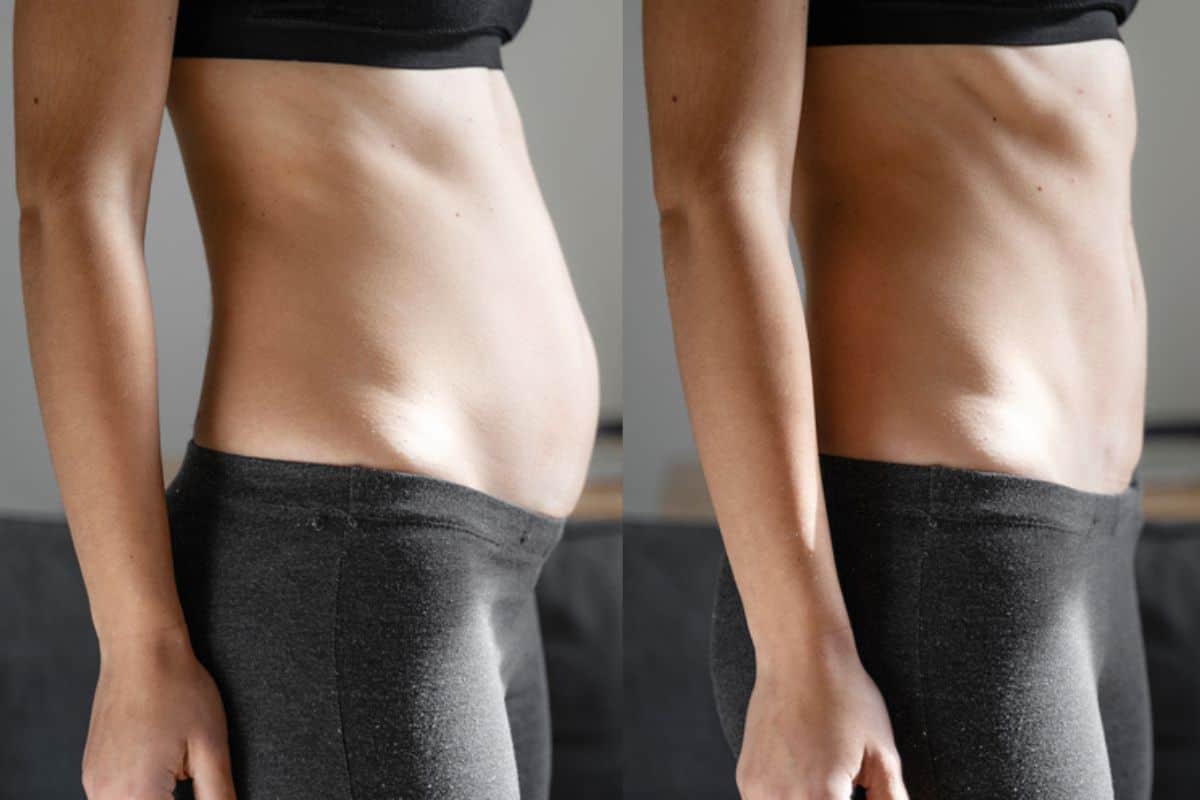 Post-Pregnancy: What Happens to Your Abdominal Muscles After Birth Nottingham