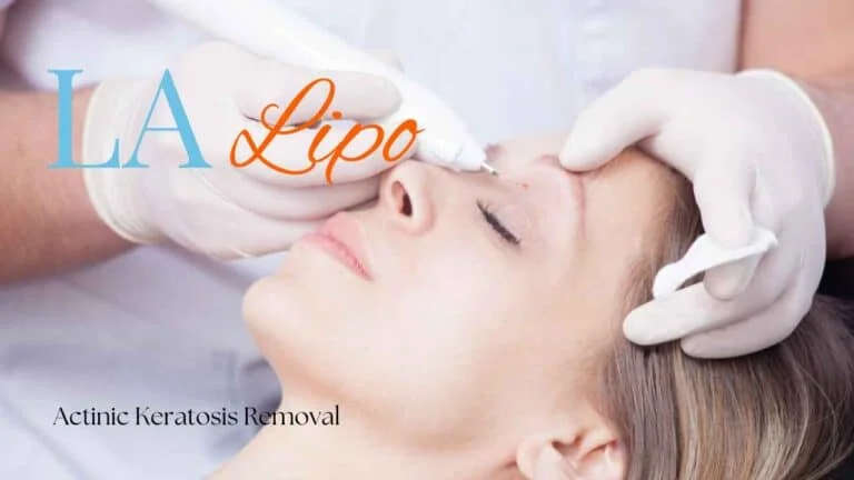 Woman receiving Actinic Keratosis Removal Treatment Nottingham