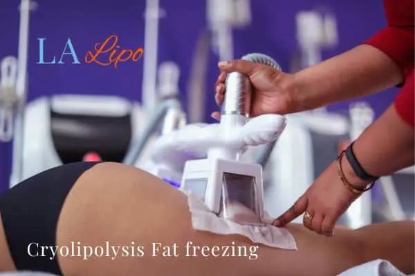 women getting fat freezing Nottingham