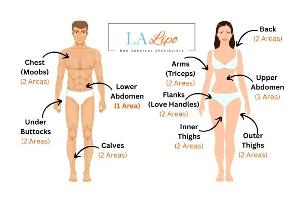 LA LIPO Cryolipolysis Areas Nottingham