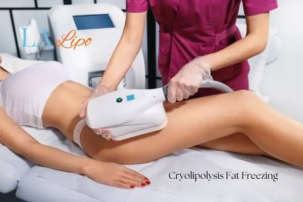 Woman receiving coolsculpting Nottingham treatment on her thighs