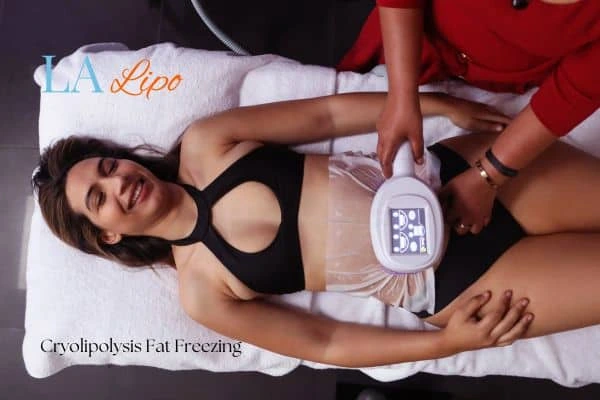 woman getting cryolipolysis Nottingham