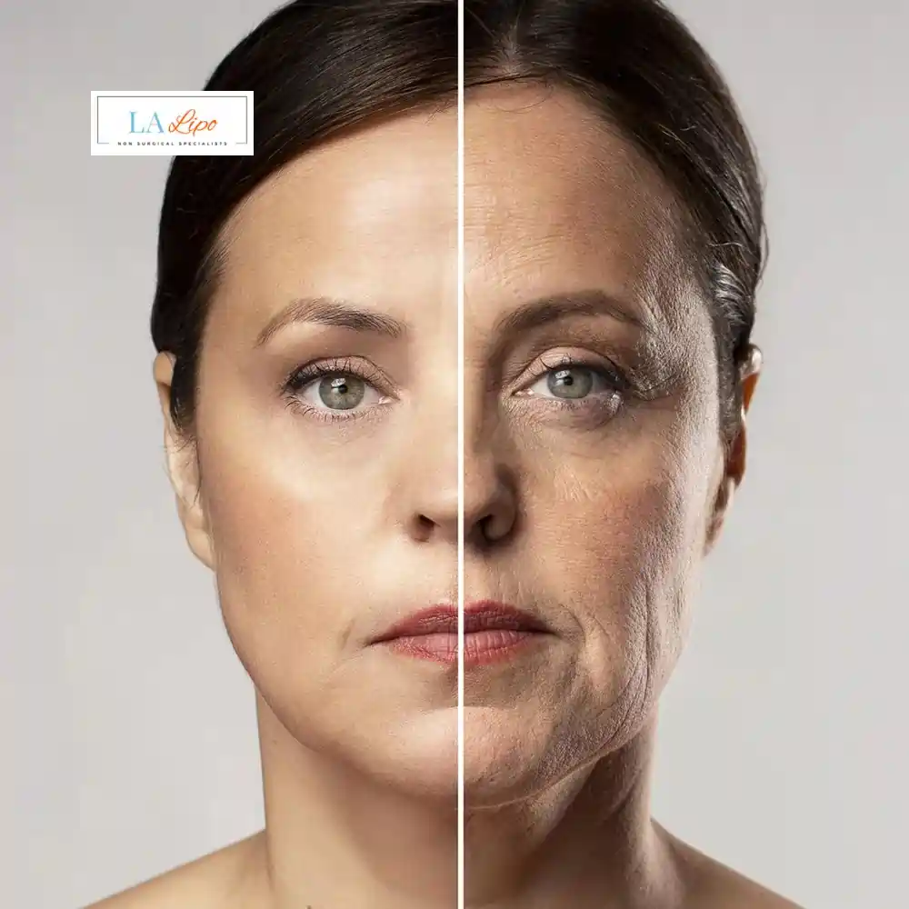 How Can You Tell If Non-Surgical Skin Tightening Is Right for You Nottingham?