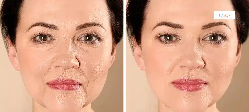 How Long Does It Take to See Results and How Long Do They Last Nottingham?