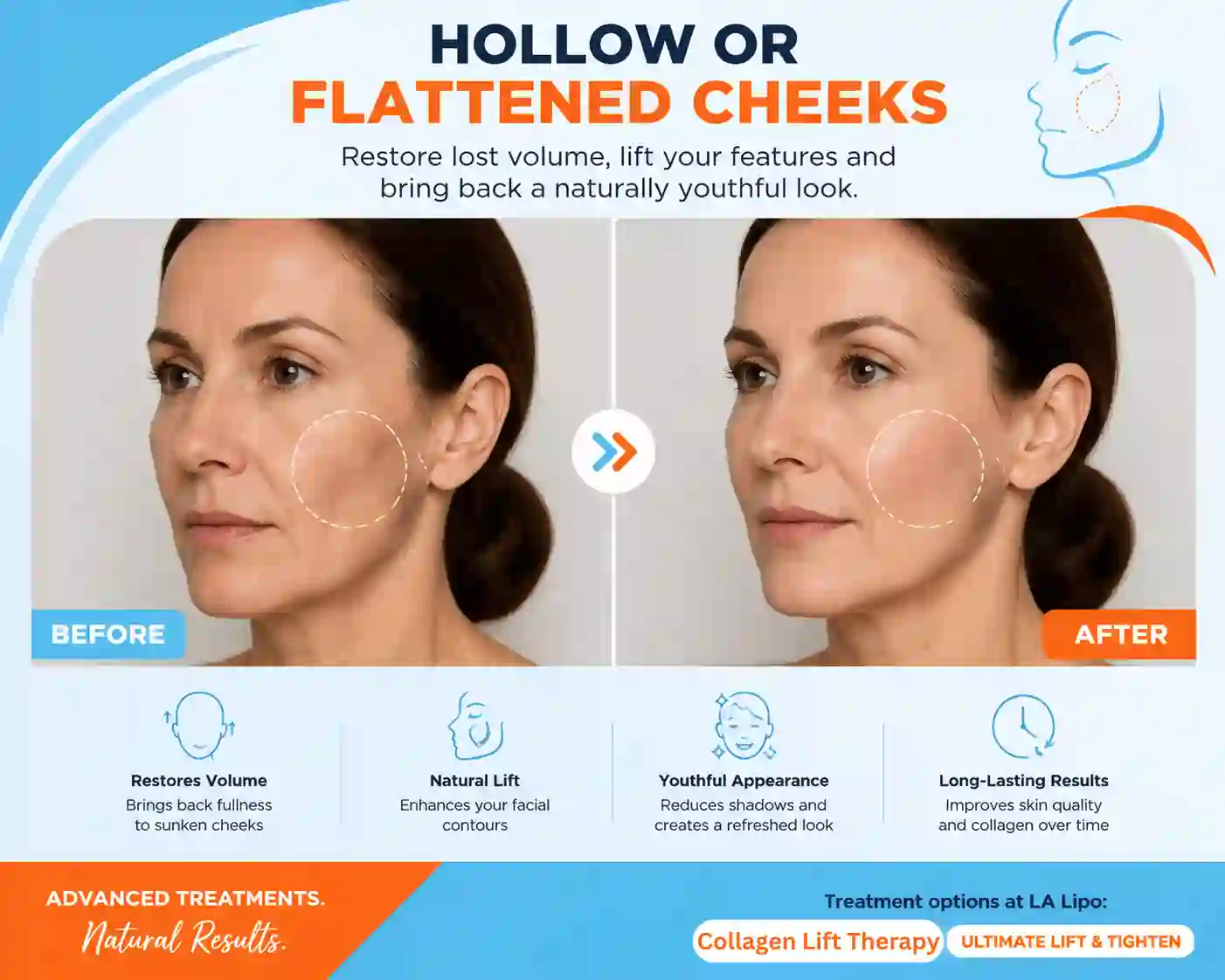 Sign #4: Hollow or Flattened Cheeks Nottingham