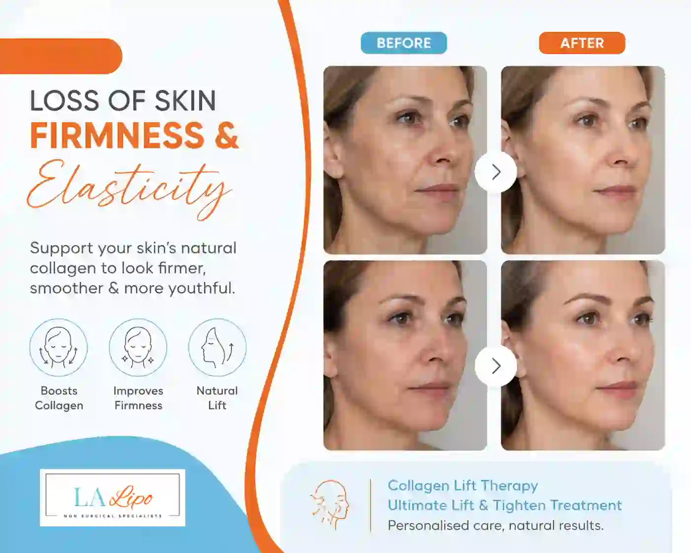 Sign #7: Loss of Skin Firmness and Elasticity Nottingham