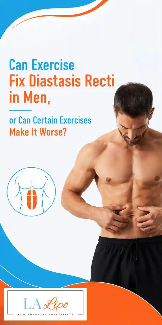Can Exercise Fix Diastasis Recti in Men, or Can Certain Exercises Make It Worse Nottingham?