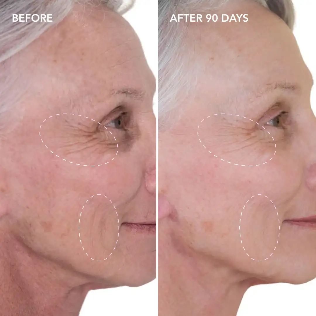 When will you see results Nottingham